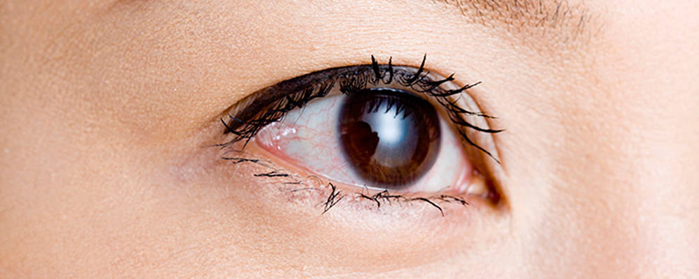 くっきりコンタクト キャンペーン情報